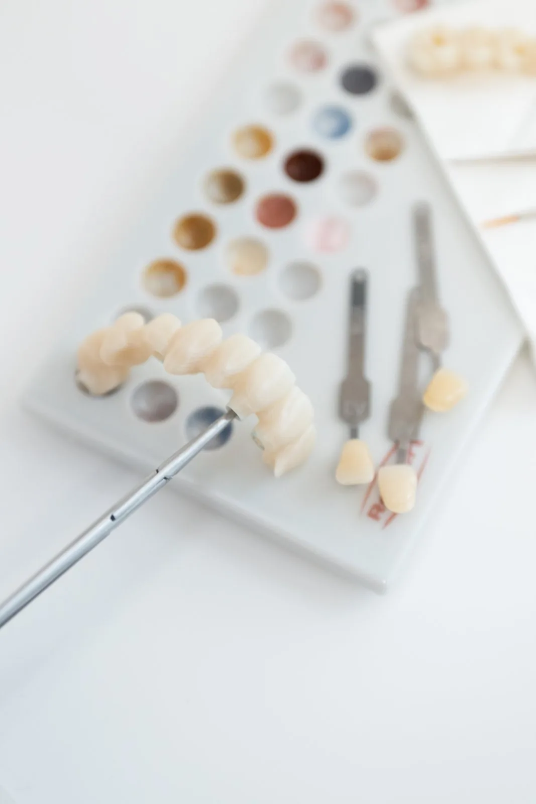 Veneers